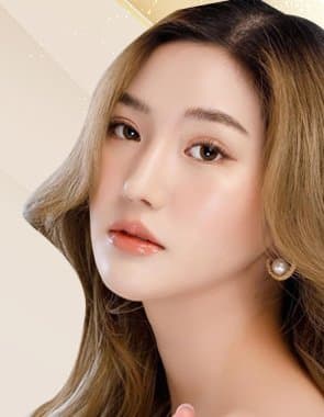 Nâng mũi bọc sụn