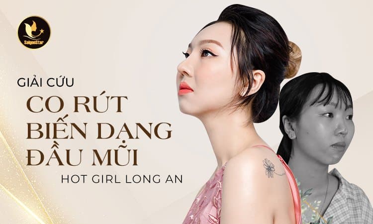 Giải cứu co rút biến dạng đầu mũi hot girl Long An