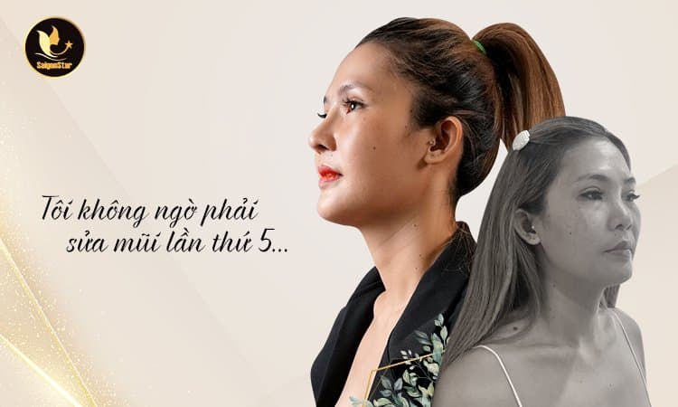 Đây là lần sửa mũi thứ 5 của chị