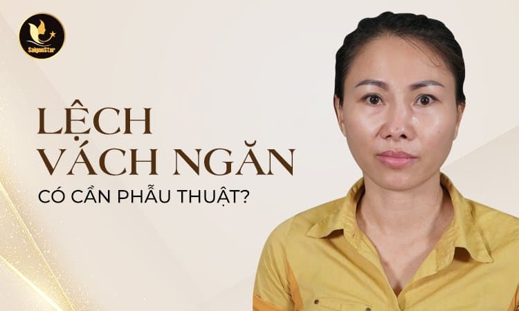 Lệch vách ngăn mũi có cần phẫu thuật?