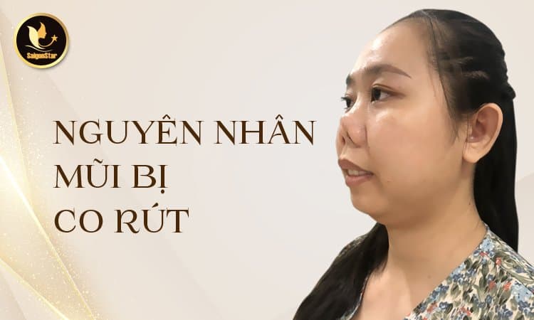Nguyên nhân mũi bị co rút