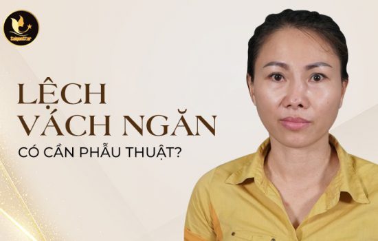 Lệch vách ngăn mũi có cần phẫu thuật?