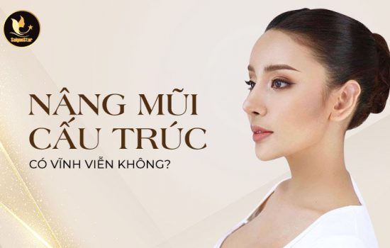 Nâng mũi cấu trúc có vĩnh viễn không?