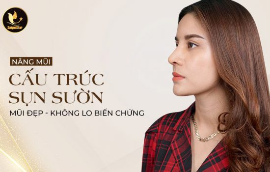 Nâng mũi cấu trúc sụn sườn