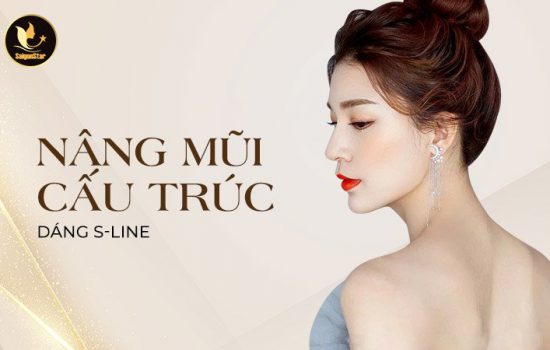 Nâng mũi cấu trúc dáng S-line